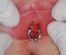 Hymen piercing