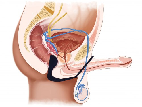 Stimulátor prostaty s kroužkem na penis