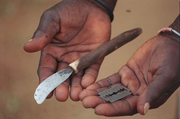 Ženská obřízka je většinou prováděna primitivními nástroji v nehygienických podmínkách.