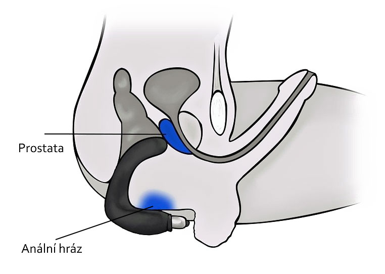 Rovným vibrátorem na prostatu dosáhnout v podstatě nelze. Vhodné jsou vibrátory zahnuté. Případně při masáží jen rukou, je potřeba ohnout prsty.