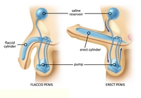 Umístění a funkce pumpy penilní protézy uvnitř mužského těla