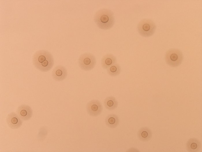 Mycoplasma hominis