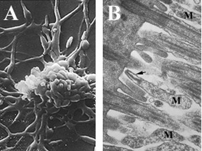 Mycoplasma pneumoniae